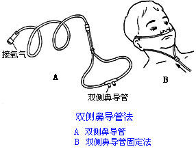 ◆肺病患者如何家庭氧療？